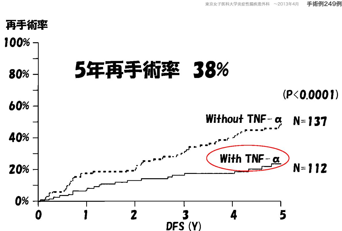 吻合部再発・再手術防止に手術後の内科治療（TNF-α抗体）は有効です