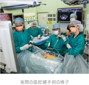 実際の腹腔鏡手術の様子