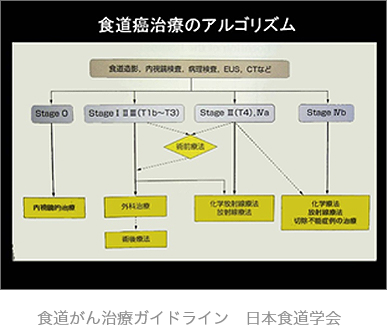 食道がん治療ガイドライン 日本食道学会