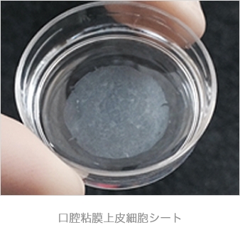 口腔粘膜上皮細胞シート